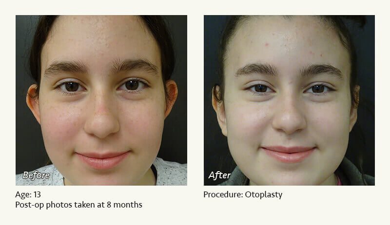 Pin on Cosmetic Surgery Recovery Products